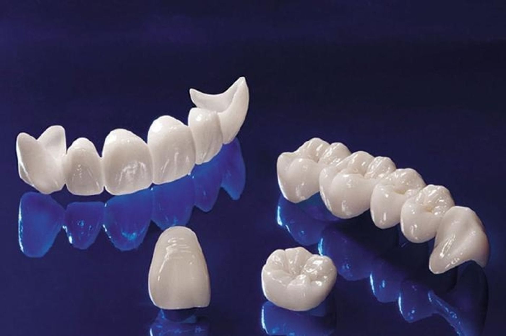 Răng sứ Zirconia - Loại răng sứ phổ biến hàng đầu hiện nay