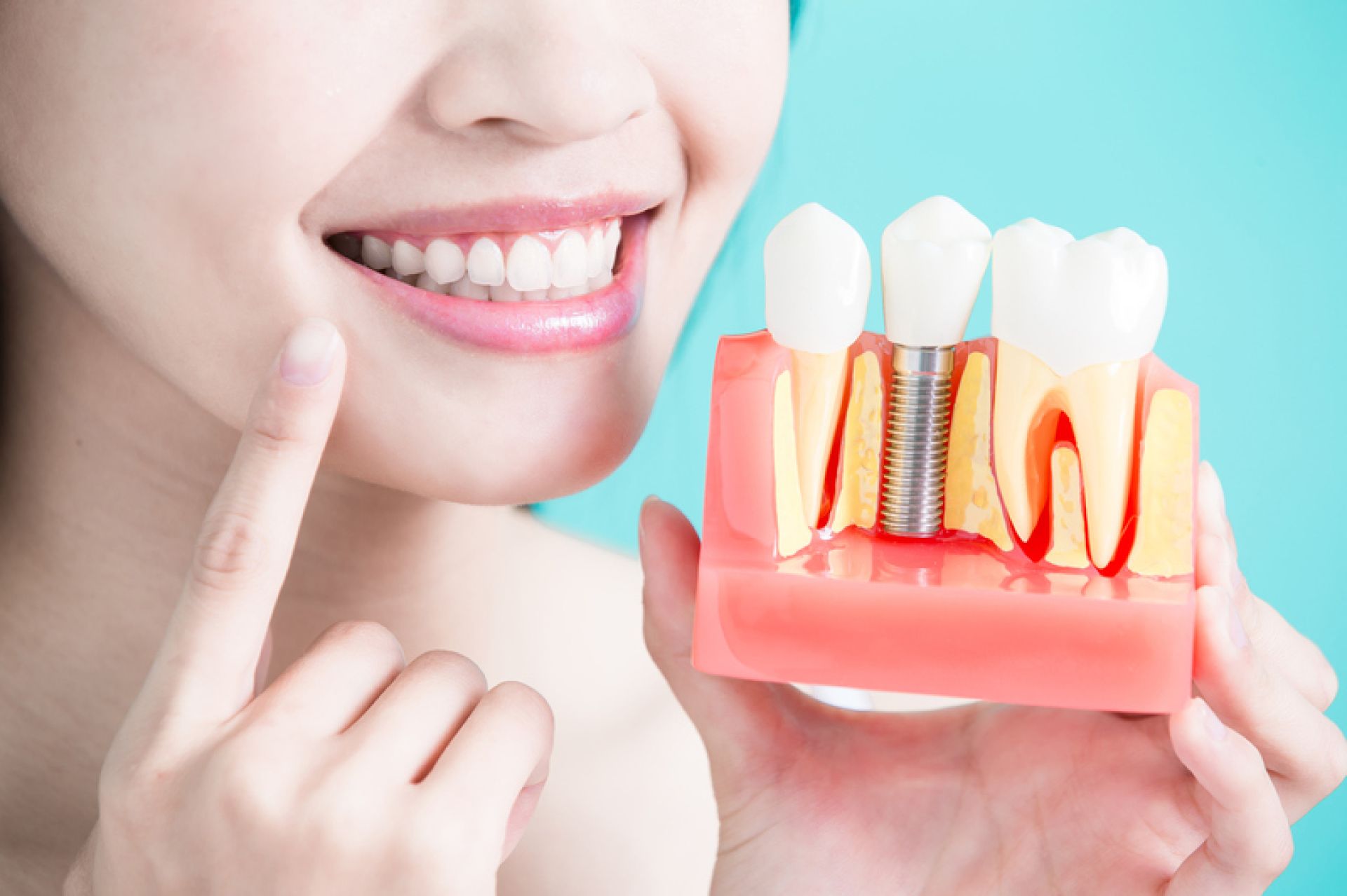 Trồng răng Implant có đau không và câu trả lời từ chuyên gia