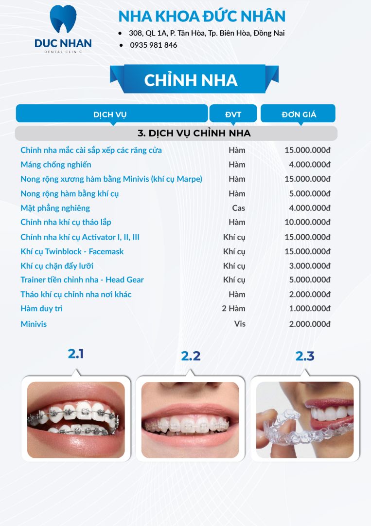 Bảng giá niềng răng Biên Hòa - Nha khoa Đức Nhân