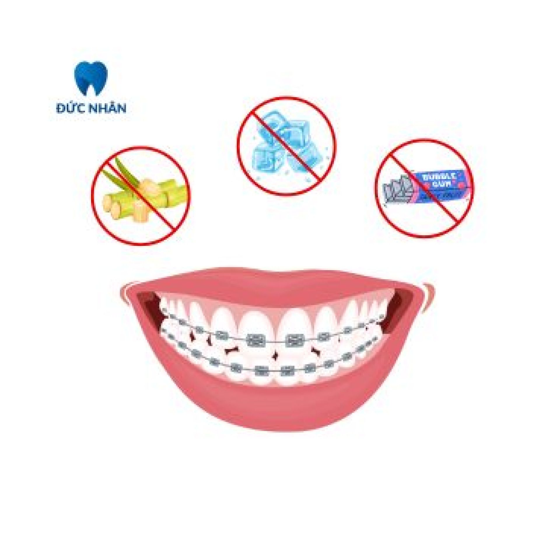 đồ ăn cho người niềng răng