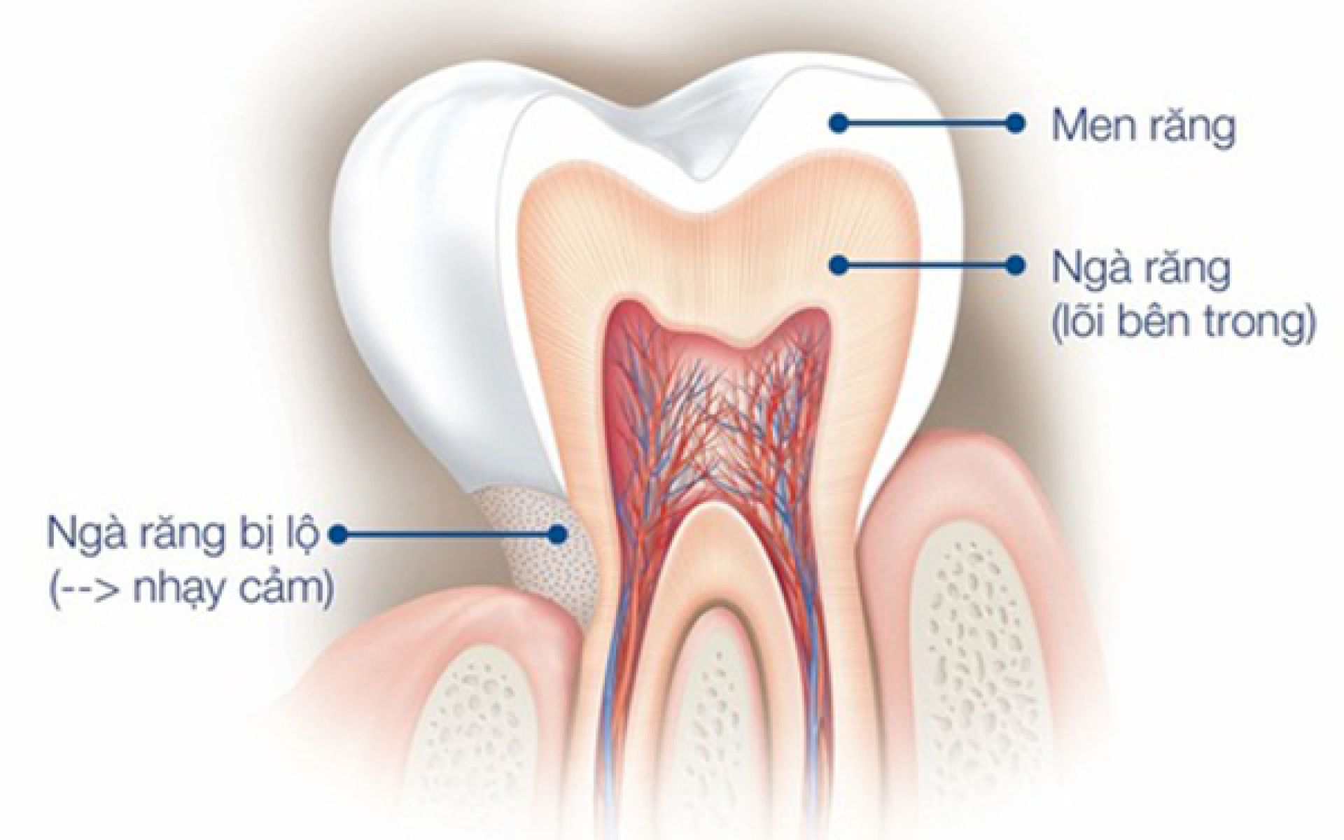 Nguyên nhân gây ê buốt răng ở mọi lứa tuổi