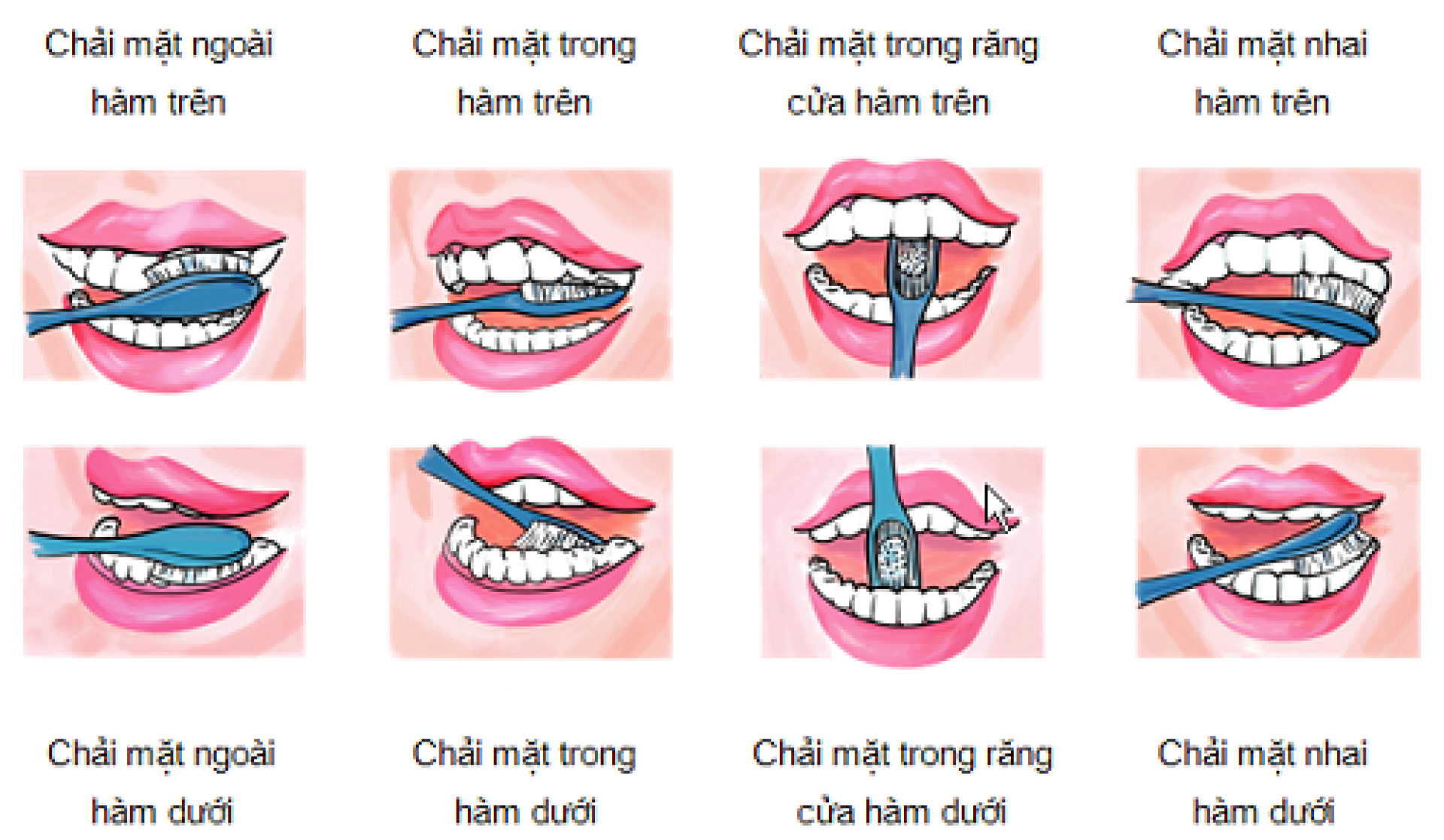 Vệ sinh răng đúng cách để khắc phục ê buốt răng tại nhà