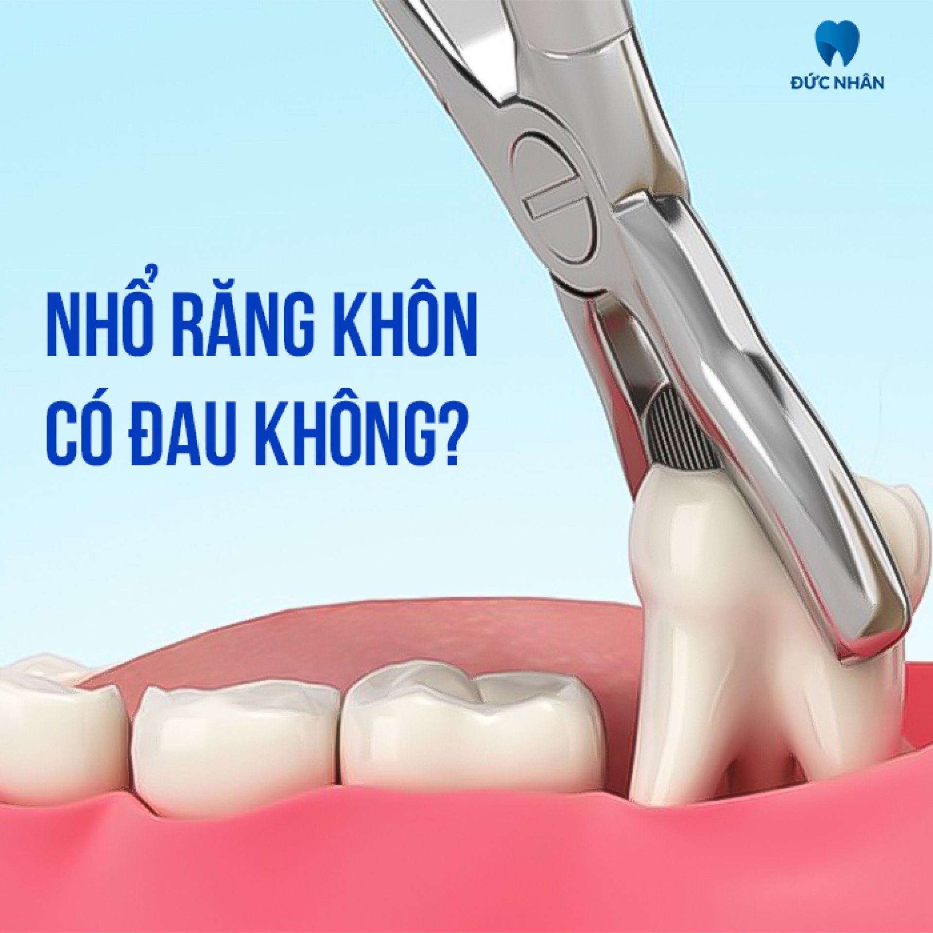  Nhổ răng khôn có đau không?