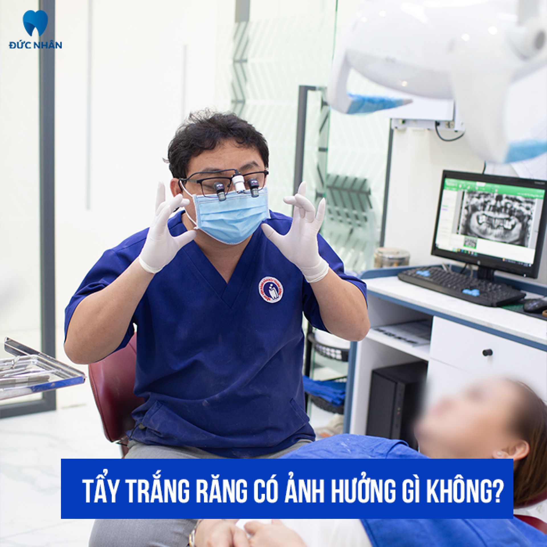 Tẩy trắng răng có ảnh hưởng gì không?
