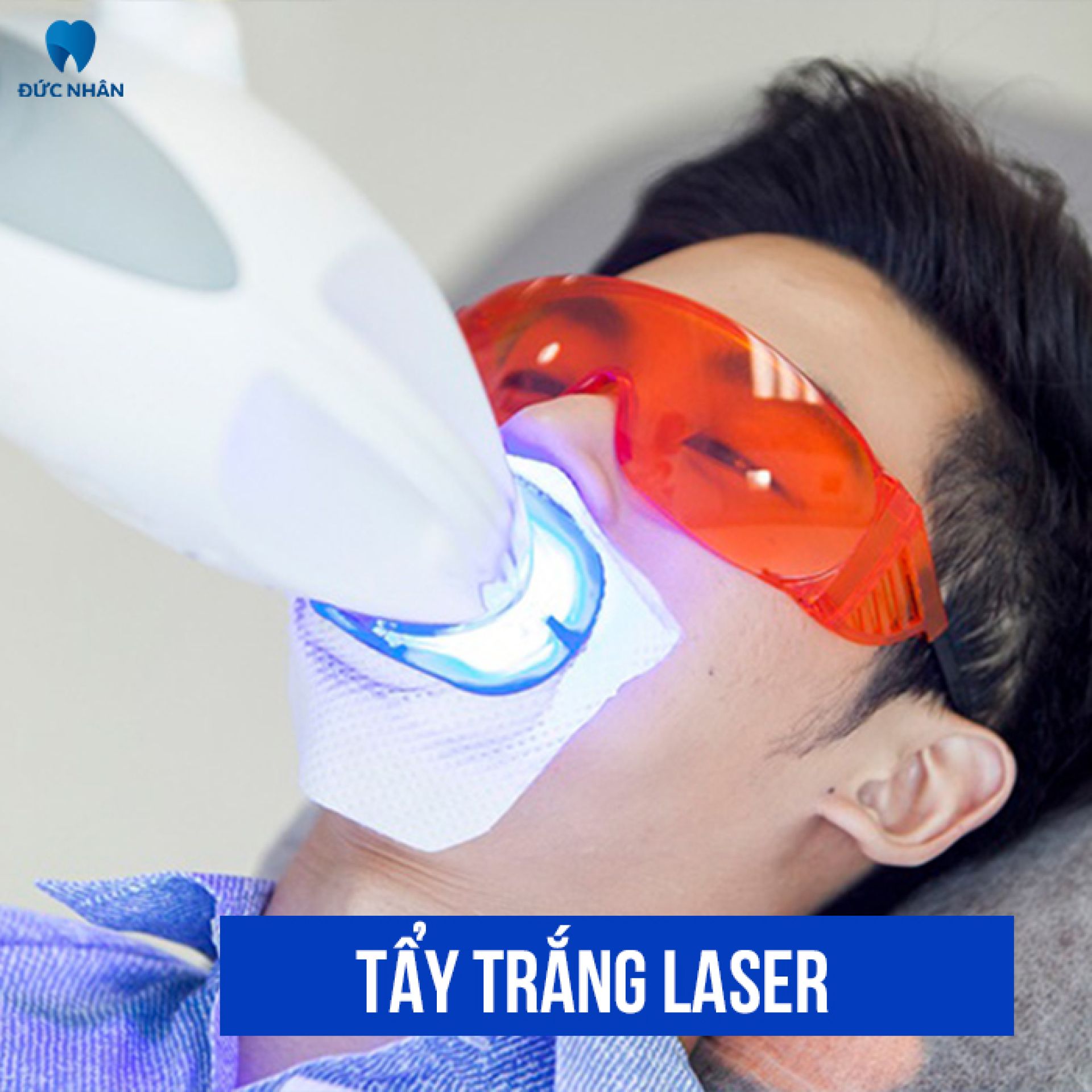 Tẩy trắng răng bằng công nghệ Plasma