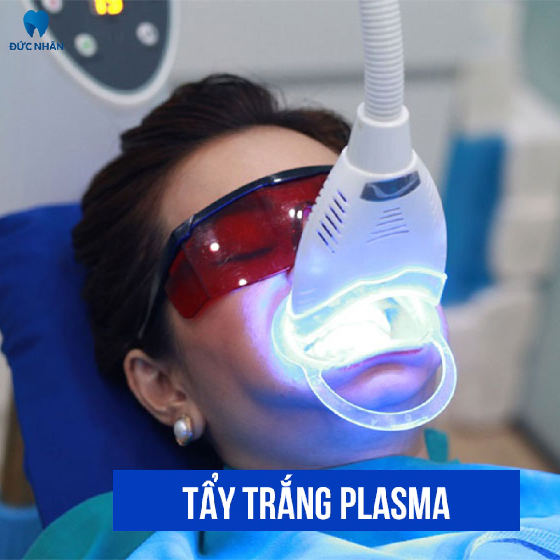 Tẩy trắng răng bằng công nghệ Plasma