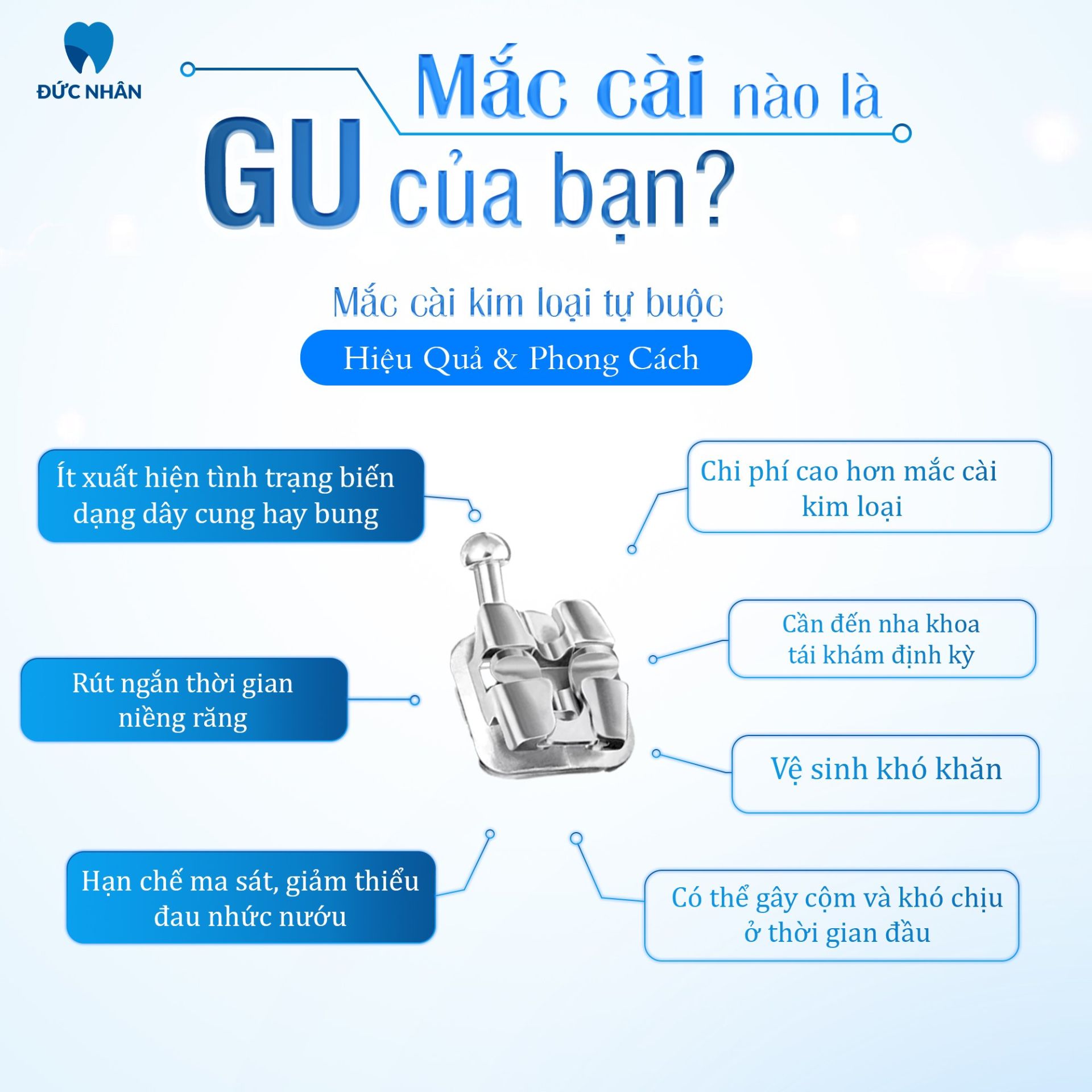 Mắc cài kim loại tự buộc là gì và ưu, nhược điểm