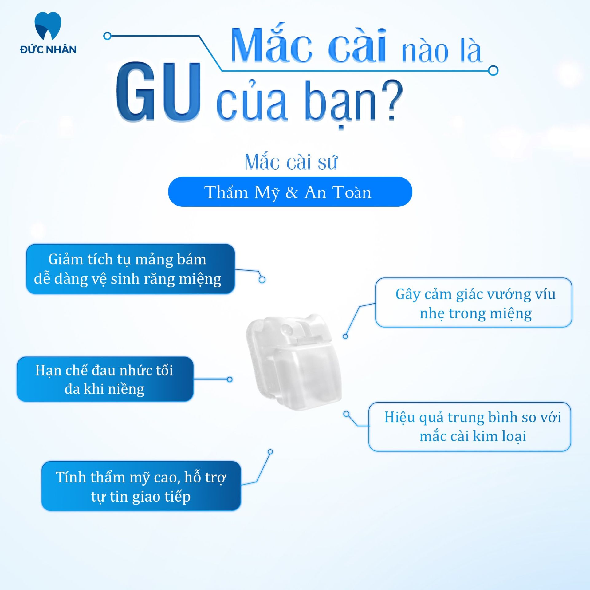 Mắc cài sứ là gì và ưu, nhược điểm