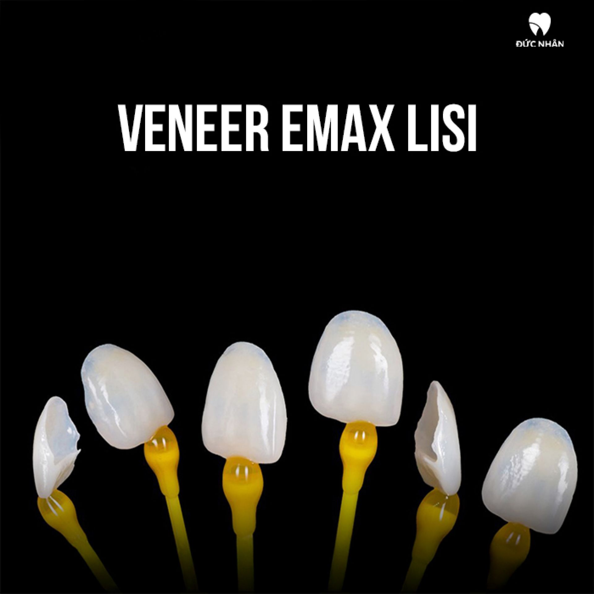 Veneer Emax Lisi - Nhật 