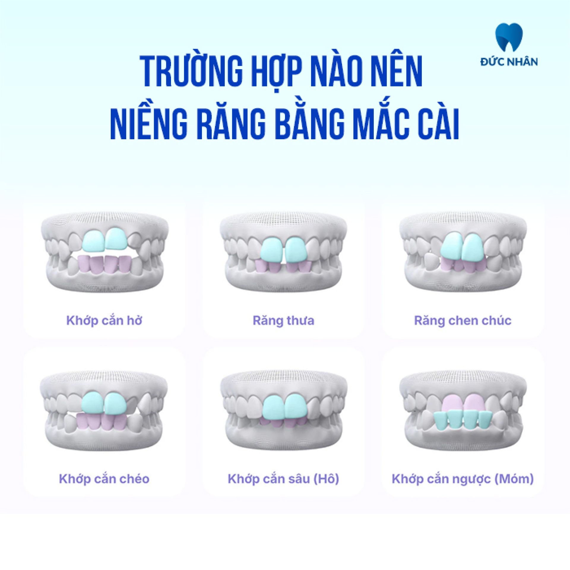 Những trường hợp nào nên niềng răng bằng mắc cài - Nha khoa Đức Nhân Biên Hòa