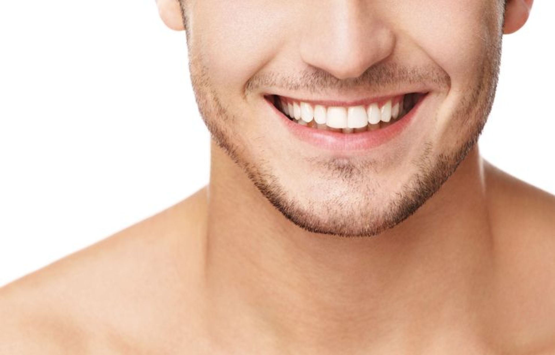 hollywood smile