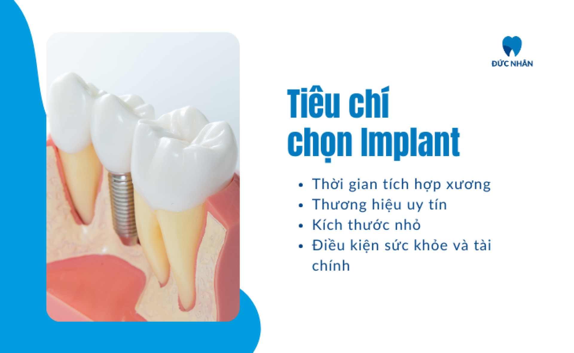 Những tiêu chí lựa chọn dòng trụ Implant