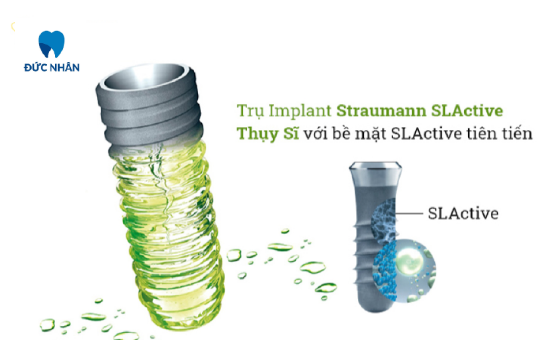 Trụ Straumann (Thụy Sĩ) - Các dòng trụ Implant phổ biến