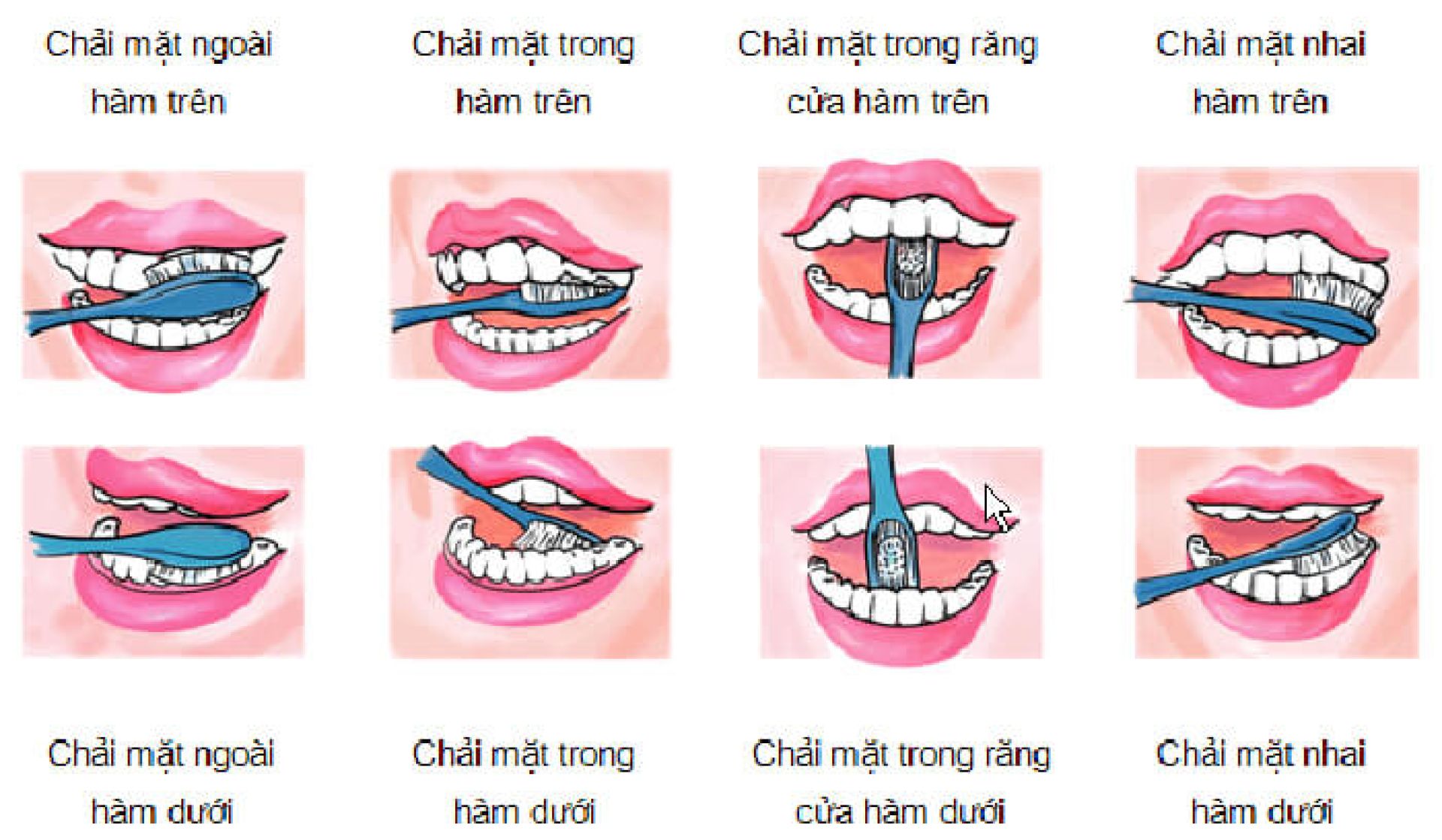 Sử dụng kỹ thuật đánh răng đúng để đảm bảo chăm sóc răng sau khi trồng răng Implant tối ưu